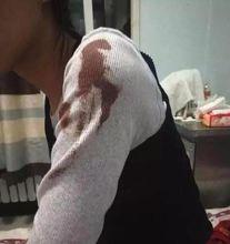 2&middot;18內蒙古突泉縣砍人事件