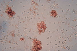 直接凝集反應 直接凝集反應