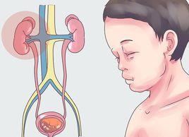 小兒腎病 小兒腎病