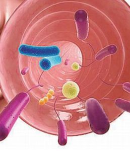 腸道炎症 腸道炎症