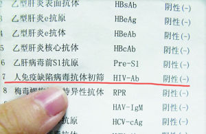 愛滋病檢測 愛滋病檢測