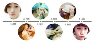 中山醫3.5°炫彩雙眼皮