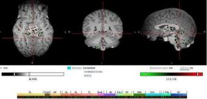 數字人腦地圖 數字人腦地圖