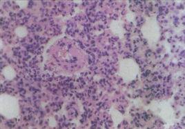 紫色色桿菌 紫色色桿菌