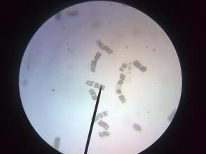 細小平裂藻 細小平裂藻