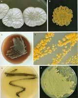 均勻諾卡氏菌津山亞種 均勻諾卡氏菌津山亞種