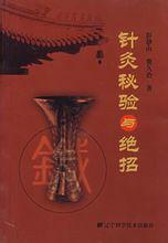 針灸秘驗與絕招 針灸秘驗與絕招