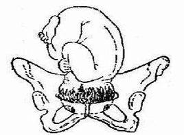 臨產後胎頭銜接較晚 臨產後胎頭銜接較晚