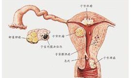 陰道出血 陰道出血
