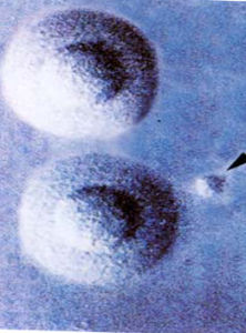 人型支原體 人型支原體