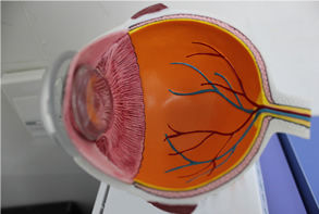 嬰幼兒先天性白內障 嬰幼兒先天性白內障