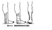 踝部扭傷 踝部扭傷
