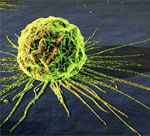 iCTS腫瘤免疫細胞治療體系