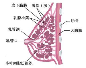 （圖）原發性乳腺淋巴瘤