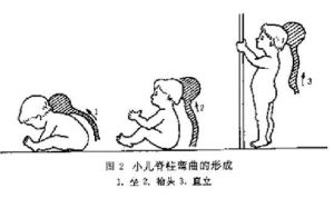 強迫體位 強迫體位