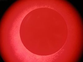 羅氏菌屬 羅氏菌屬