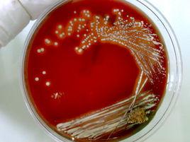 痤瘡丙酸桿菌 痤瘡丙酸桿菌