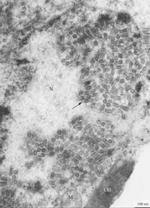感染水稻黃矮病毒的水稻葉片薄壁細胞