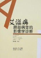 愛滋病肺部病變的影像學診斷 愛滋病肺部病變的影像學診斷