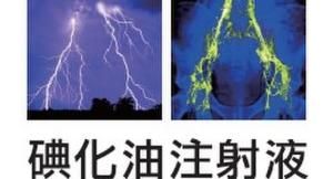 碘化油注射液 碘化油注射液