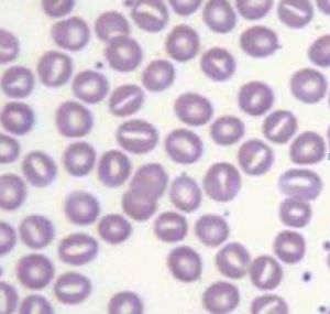 口形紅細胞