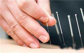 粗針療法 粗針療法