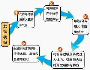 塵蟎過敏性哮喘