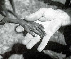 1953-1956年水俁病事件 1953-1956年水俁病事件