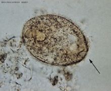 結腸小袋纖毛蟲