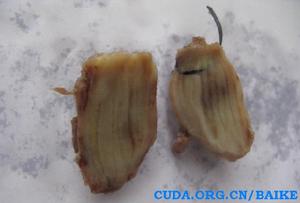 增生性肌炎 增生性肌炎