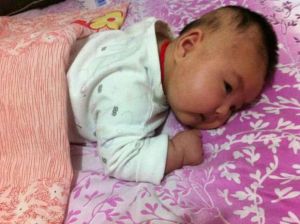 肌張力高 肌張力高