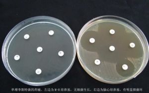 酸水解酪蛋白 酸水解酪蛋白