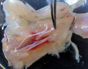 曼氏裂頭絛蟲 曼氏裂頭絛蟲