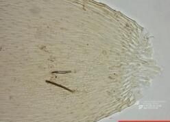 巴塔麻錦蘚 巴塔麻錦蘚