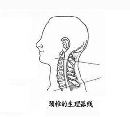 頸椎弧 頸椎弧