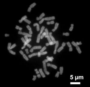 電子顯微鏡下的人類染色體