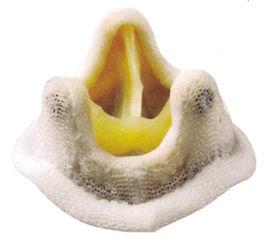 HancocK II生物瓣膜假體 HancocK II生物瓣膜假體