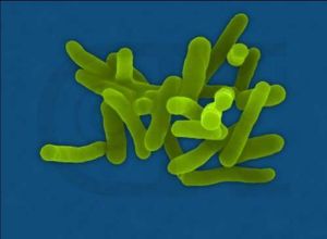 志賀氏菌 志賀氏菌