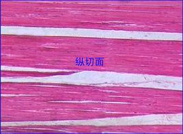 橫紋肌A帶 橫紋肌A帶