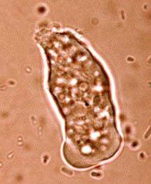 烏龜原蟲病 烏龜原蟲病