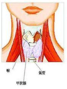 甲狀腺危象 甲狀腺危象