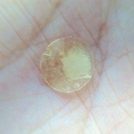 痘痘隱形貼 痘痘隱形貼