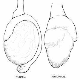 睪丸異常 睪丸異常