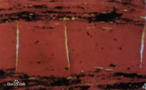 無結構鏡質體 無結構鏡質體