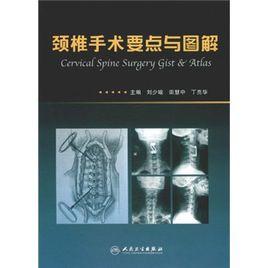 頸椎手術要點與圖解 頸椎手術要點與圖解