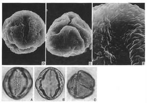 Taihangia rupestris Yu et C. L. Li 花粉 (李朝鑾，郭聚剛 1034，PE)；(A) 赤道面觀，表示萌發孔，LMX1000；(B) 赤道光切面，LMX1000；(C) 斜極面觀，LMX1000；(D) 赤道面觀，表示萌發孔和紋飾，SEMX1800；(E) 極面觀，SEMX1800；(F) 萌發孔和紋飾細節，SEMX6000。
