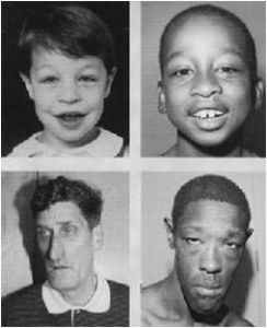 脆性X染色體綜合徵