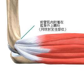 高爾夫球肘 高爾夫球肘