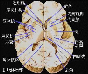 （圖）新大腦皮質