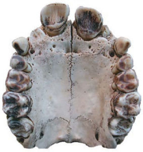 毛里坦猿人化石